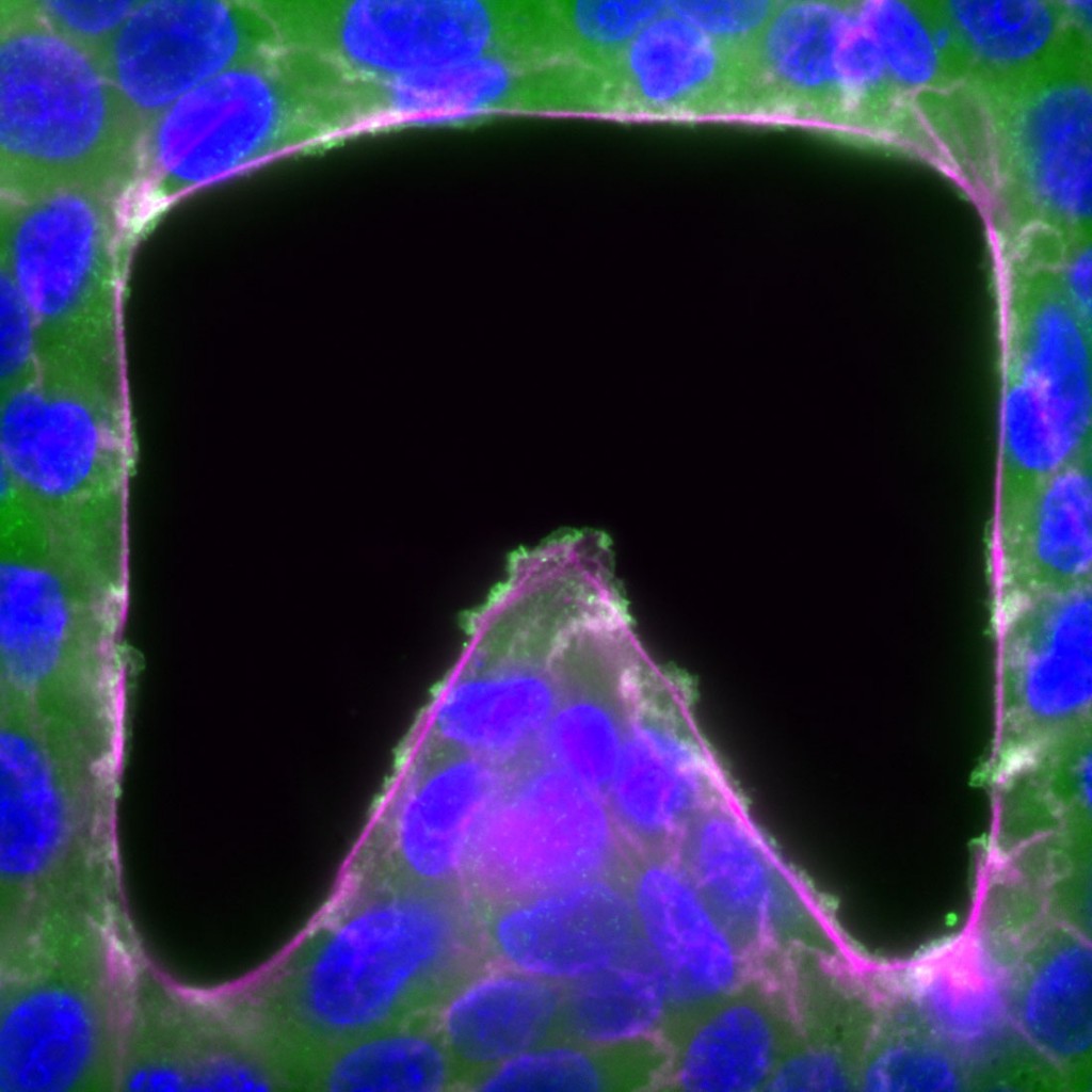 ImageJ=1.47v unit=micron