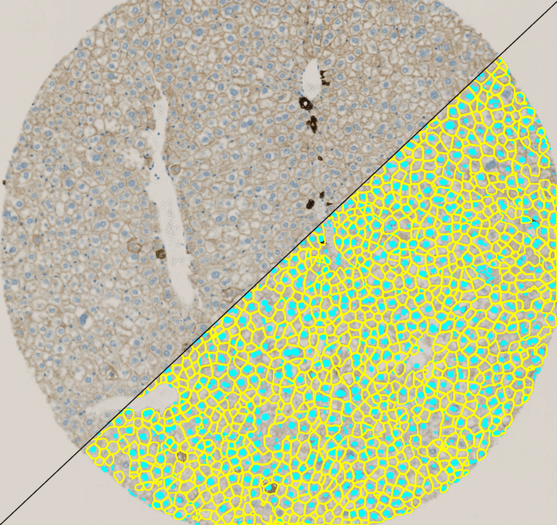 membran detection PRE-POST_triangle